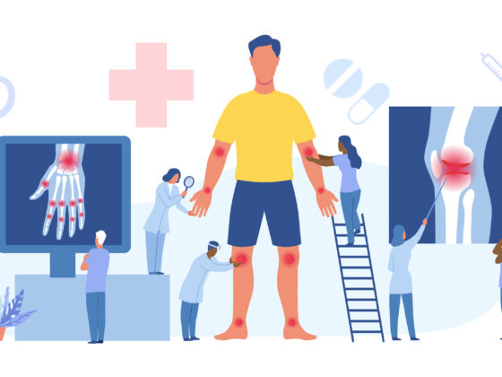 Schede di rischio sovraccarico biomeccanico arti superiori Inail